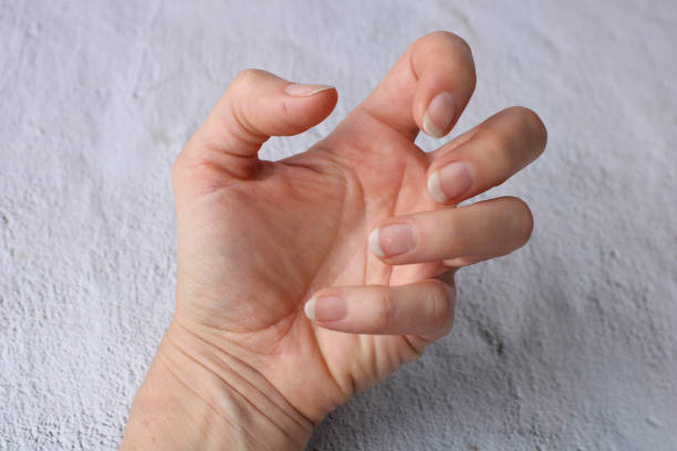 istock Close up dirty hand nails on white background have copy space for put text. Concept unhealthy because can have bacteria make sick people 1192862317