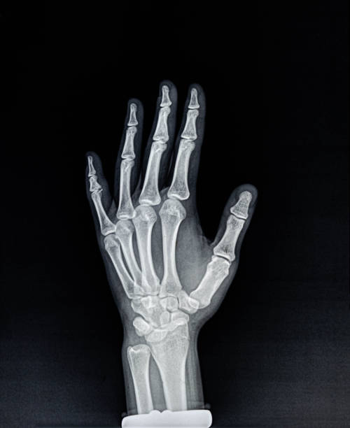 istock Palm X-ray Film 1192875248