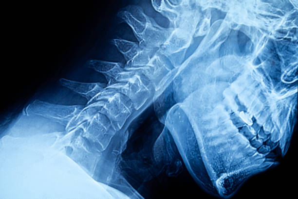 3DCG anatomical skeleton