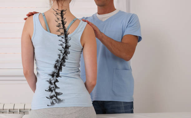 scoliosi spine curve anatomy, correzione postura. trattamento chiropratico, sollievo dal dolore alla schiena. - scoliosis foto e immagini stock