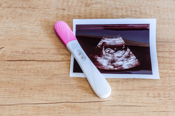 istock Pregnancy test showing a positive result and ultrasound image. 1193389080