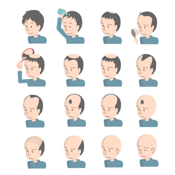 Men with thinning hair Men with thinning hair skinhead haircut stock illustrations