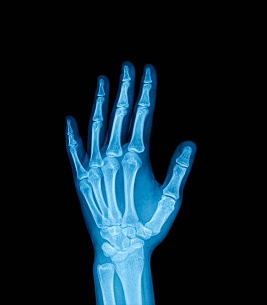 filme de raio-x de palma - articulação mão humana - fotografias e filmes do acervo