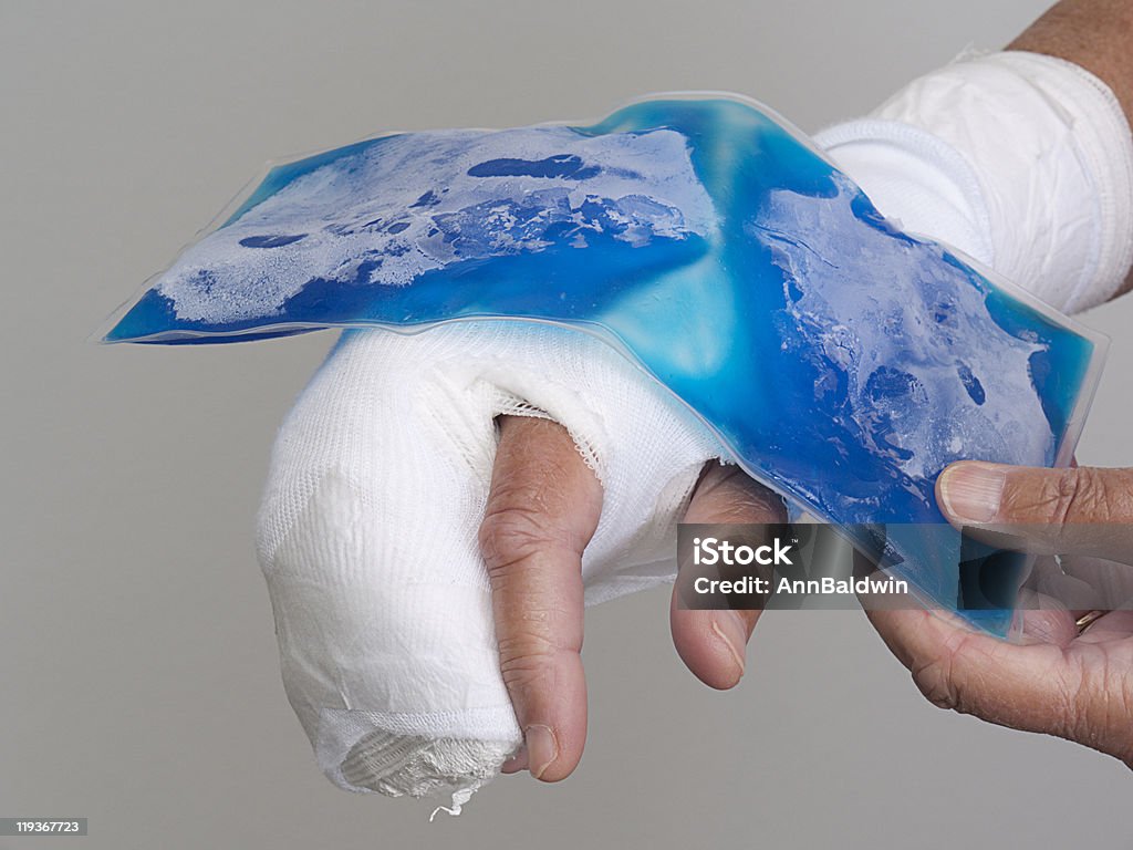 Gel ice-pack être placé sur le bandage des mains - Photo de Bandage libre de droits