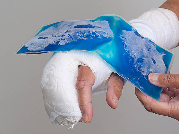 Gel ice-pack being placed on bandaged hand stock photo