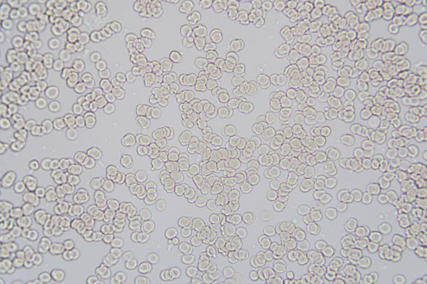 grossissement microscopique d'image de cellules sanguines x 400 - microscope view photos et images de collection