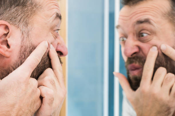 istock Man looking at pimples on his face 1193726878