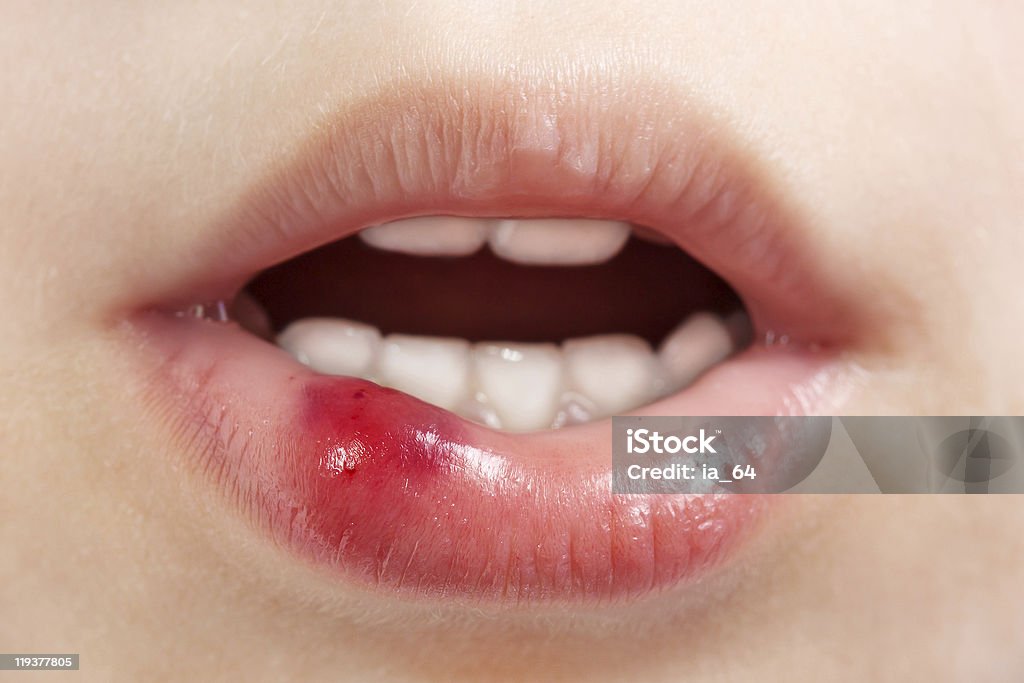 Wound child  Human Lips Stock Photo