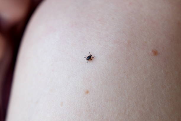 istock Dangerous encephalitis tick (Ixodes ricinus) creeps on human skin. 1193915037