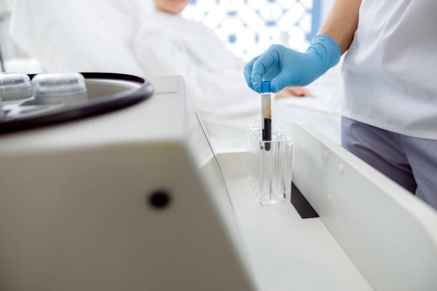 istock Close up of preparation in plasmolifting procedure 1193951403