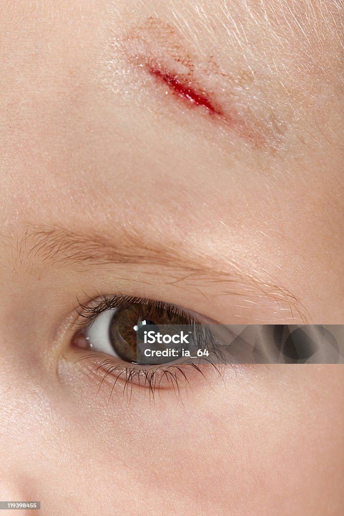 Wound child  Blood Stock Photo