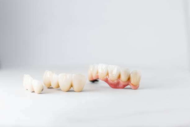 istock Dental crowns on the white background 1194029329