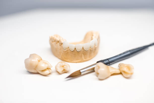istock Model of artificial jaw with teeth 1194029342
