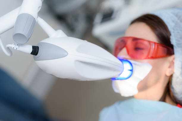 o paciente passa por um procedimento para clareamento dos dentes com uma lâmpada ultravioleta - dentists chair dentist office chair orthodontist - fotografias e filmes do acervo