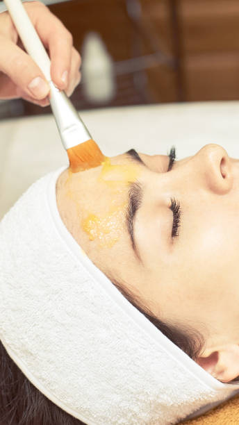 chemic facial and body peel. Cosmetology acne treatment. Young girl at medical spa salon chemic facial and body peel. Cosmetology acne treatment. Young girl at medical spa salon. facial chemical peel stock pictures, royalty-free photos & images