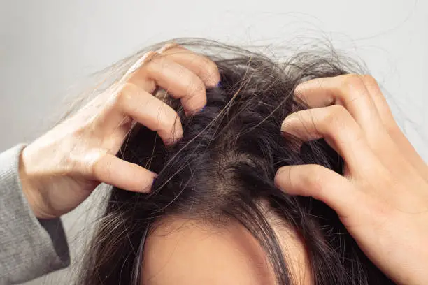 a young woman scratches her scalp and hair with her fingers. Hair health concept, scalp and hair care