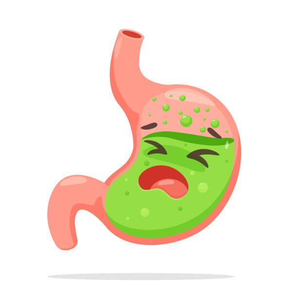 Cartoon Stomach Suffering From Acid Reflux A Stomach That Burning Like A  Fire From Acid Reflux Stock Illustration - Download Image Now - iStock