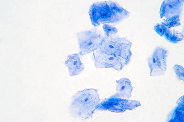 Human Cheek Epithelial Cells. The tissue that lines the inside of the mouth is known as the basal mucosa and is composed of squamous epithelial cells. Education pathology. Human Cheek Epithelial Cells. The tissue that lines the inside of the mouth is known as the basal mucosa and is composed of squamous epithelial cells. Education pathology. cheek cell stock pictures, royalty-free photos & images