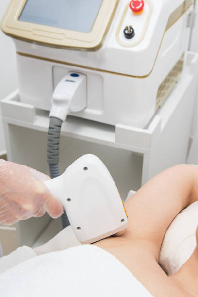 istock Laser epilation of armpits 1194602881