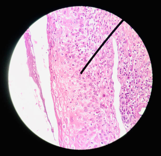 células en citología femenina reproductiva y concepto de histología técnica técnica médica. - laboratory healthcare and medicine cancer drug histology fotografías e imágenes de stock