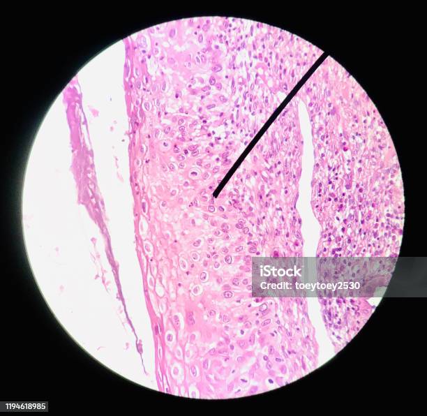 Cells In Reproductive Female Cytology And Histology Concept Medical Scinece Stock Photo - Download Image Now