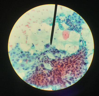 Cells in reproductive female cytology and histology concept medical scinece.