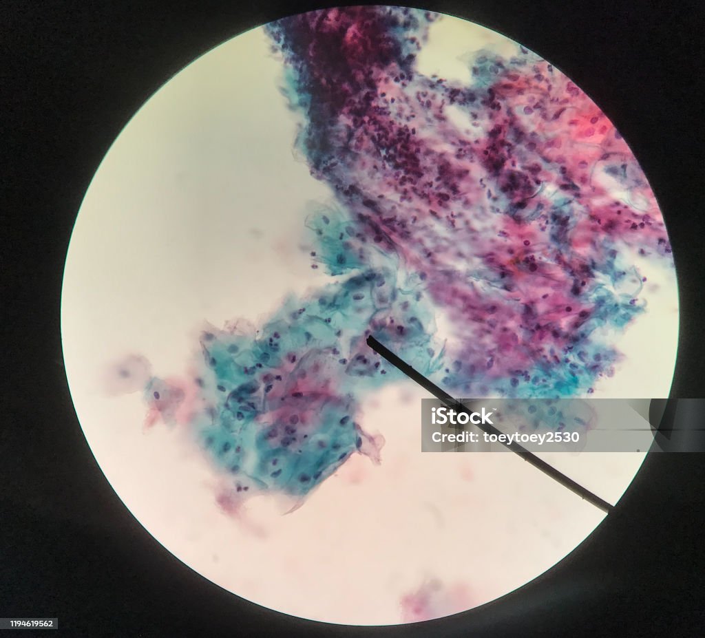 Cells in reproductive female cytology and histology concept medical scinece. Cells in reproductive female cytology and histology education concept. Pap Smear Stock Photo