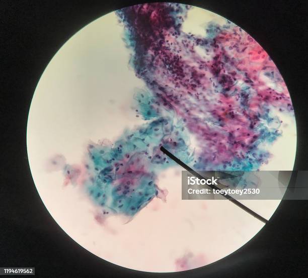 Cells In Reproductive Female Cytology And Histology Concept Medical Scinece Stock Photo - Download Image Now