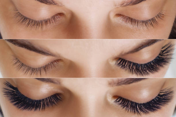 istock Eyelash Extension. Comparison of female eyes before and after 1194654114