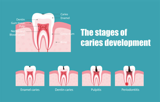 etapy rozwoju kary, ilustracja wektorowa - healthy gums obrazy stock illustrations