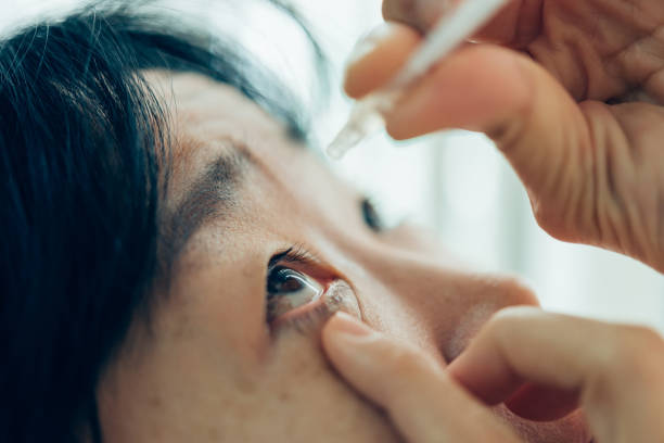 istock Woman use eye drop, artificial tears to the eye 1194657341