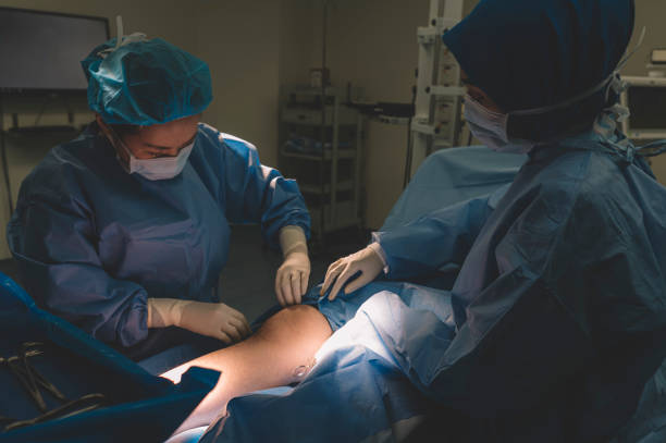a group of surgeon and nurses operating on a chinese male patient's leg in operating room a group of surgeon and nurses operating on a chinese male patient's leg in operating room surgical light stock pictures, royalty-free photos & images