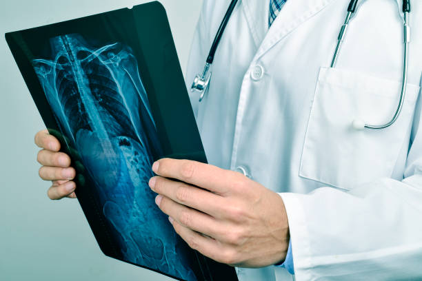 스켈레톤 방사선 그래프를 관찰하는 의사 - human lung x ray image x ray human spine 뉴스 사진 이미지