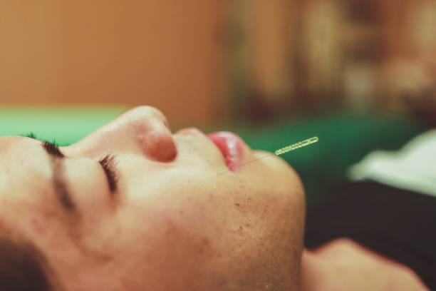 istock Cosmetic acupuncture in Asia 1194732386
