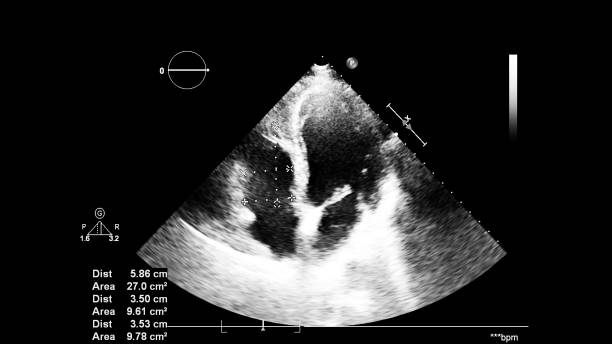 경도 초음파 중 심장의 이미지. - nexrad 뉴스 사진 이미지