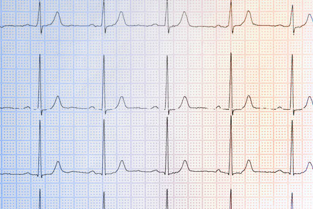 Creative glowing heartbeat hologram on blue background. Medicine and cardiology concept. 3D Rendering