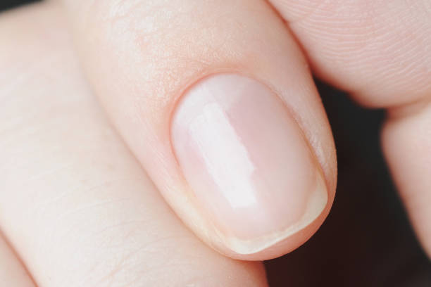 istock macro nail without manicure with perfect clean cuticle 1195473990