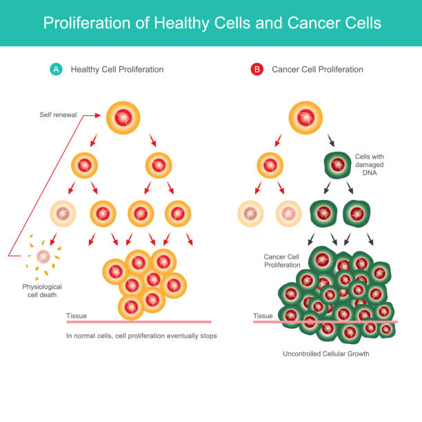 Proliferation of Healthy Cells and Cancer Cells. Comparison illustration of normal cell proliferation and Cancer cell proliferation in the body. Proliferation of Healthy Cells and Cancer Cells. Comparison illustration of normal cell proliferation and Cancer cell proliferation in the body. human body lice stock illustrations