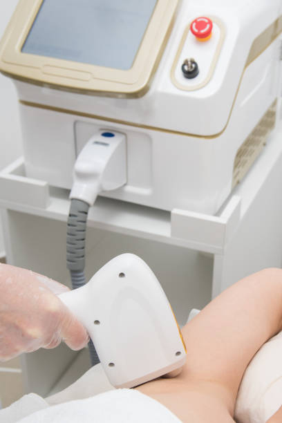 istock Laser epilation of armpits 1195605206