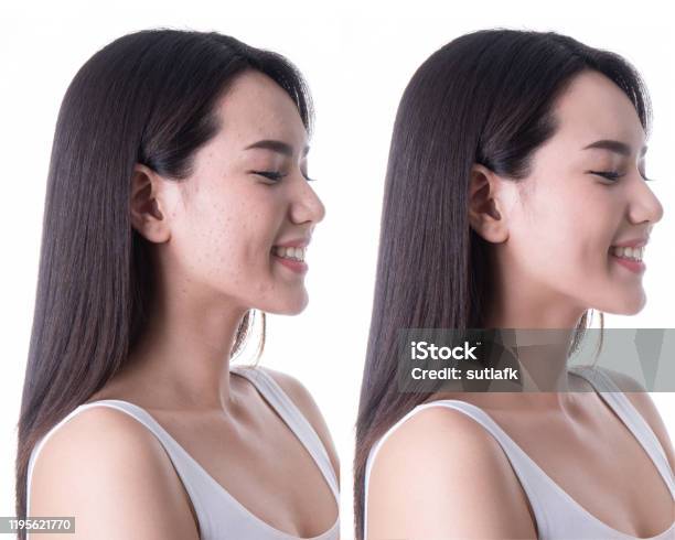 Asia Mujer Antes Y Después De Maquillaje Digital Y Retoque Cambio De Imagen En La Cara Foto de stock y más banco de imágenes de Anticipación - iStock Asia Mujer Antes Y Después De Maquillaje Digital Y Retoque Cambio De Imagen En La Cara Foto de stock y más banco de imágenes de Anticipación - iStock