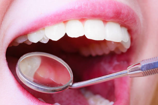 istock Woman teeth and dentist mouth mirror 1195642929