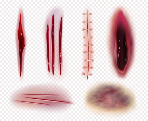 Realistic scars. Cuts wounds bruises bruises blood stitches vector templates collection Realistic scars. Cuts wounds bruises bruises blood stitches vector templates collection. Illustration injury trauma, gross laceration coloring scar stock illustrations