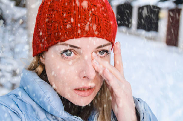 tempo frio do inverno que causa a secura e a irritação do olho - causing - fotografias e filmes do acervo