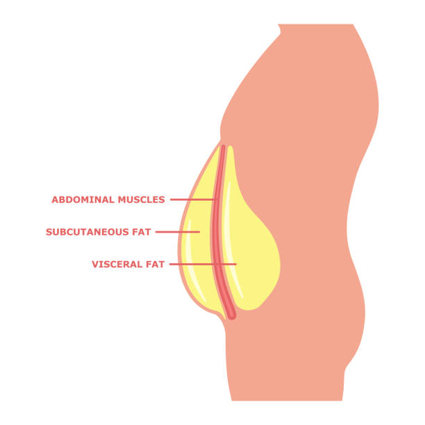 Visceral Fat In A Male Body Isolated On White Stock Illustration - Download  Image Now - Fat - Nutrient, Overweight, Abdomen - iStock