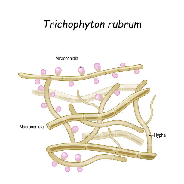 Trichophyton rubrum. Close-up of fungi with fertile hyphae, Macroconidia and Microconidia Trichophyton rubrum is a dermatophytic fungus that colonizes the upper layers of skin, and cause of athlete's foot, fungal infection of nail, and ringworm. Close-up of fungi with fertile hyphae, Macroconidia and Microconidia trichophyton fungus stock illustrations