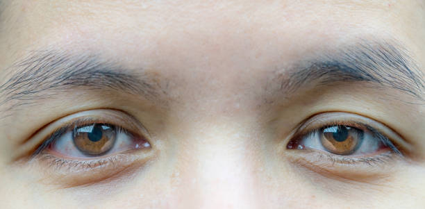 istock Cropped Eyes Of Man 1196035971