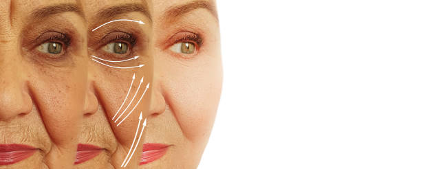 face of an elderly woman wrinkles collage  before and after treatment face of an elderly woman wrinkles before and after treatment collage botox before and after stock pictures, royalty-free photos & images