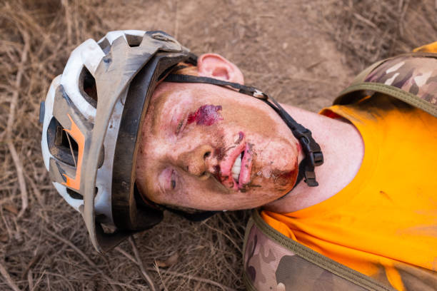 Teenager Boy Crashed Mountain Biking