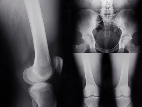 Human joint and knee X-rays
