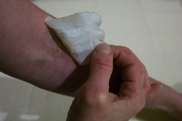 istock Removing plaster (band aid) from blood donation site 1196734901
